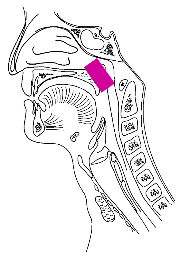 Epipharynxbehandling